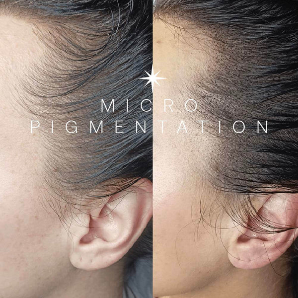 Micro-Pigmentation