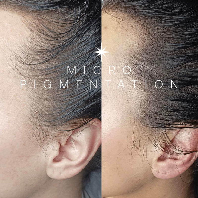 Micro-Pigmentation