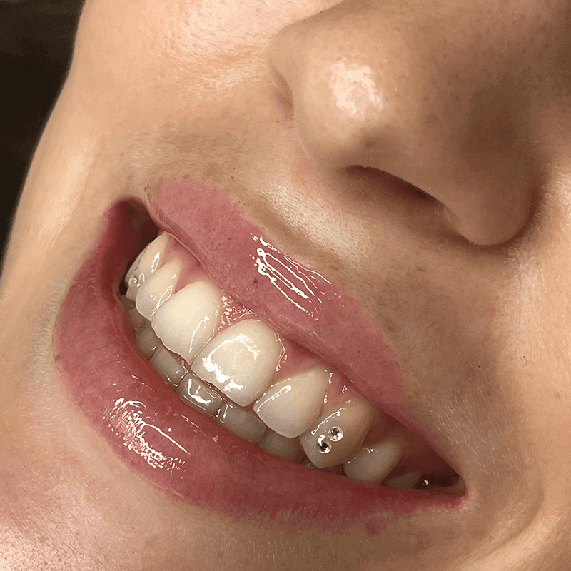 Tooth gem hot sale application near me