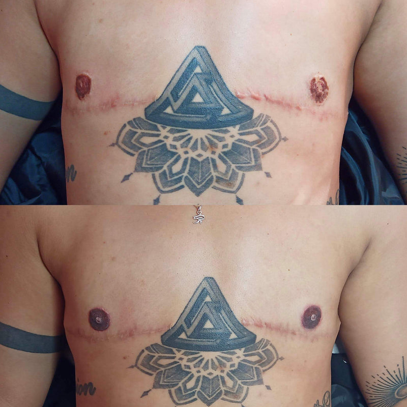 Areola Tattoo Reconstruction