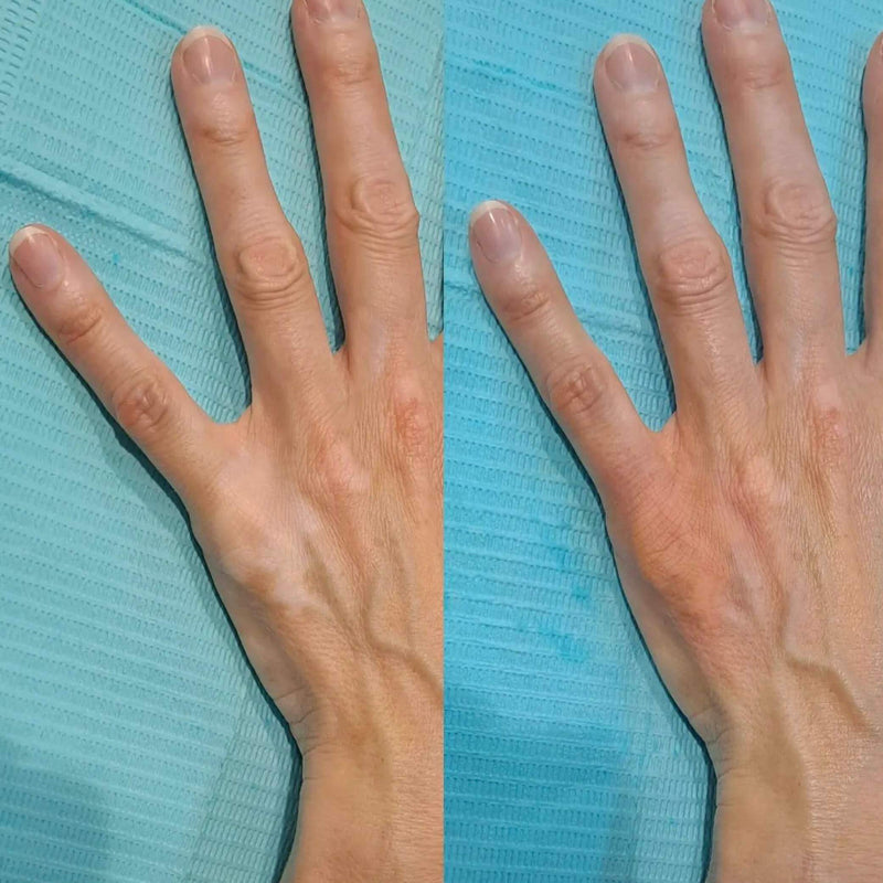 Skin Camouflage