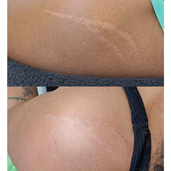 Skin Camouflage