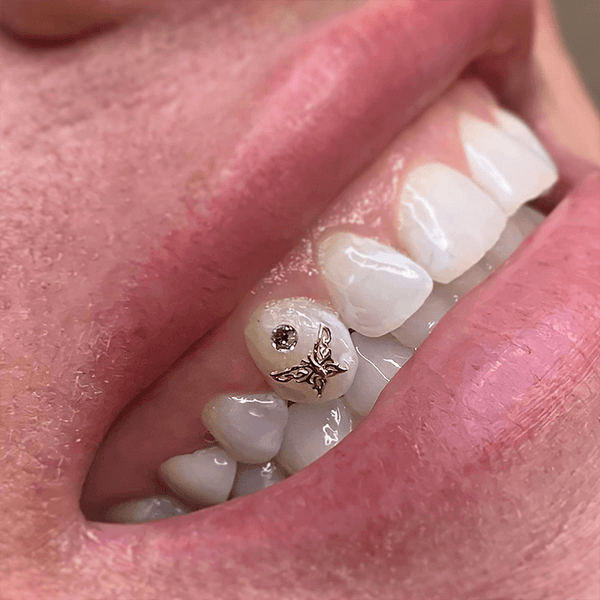 BUTTERFLY Tooth Gem -  Canada  Tooth gem, Teeth jewelry, Diamond teeth